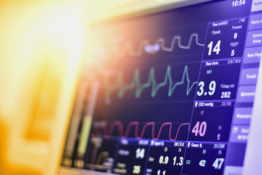 Électrocardiogramme : qu'est-ce que c'est ?