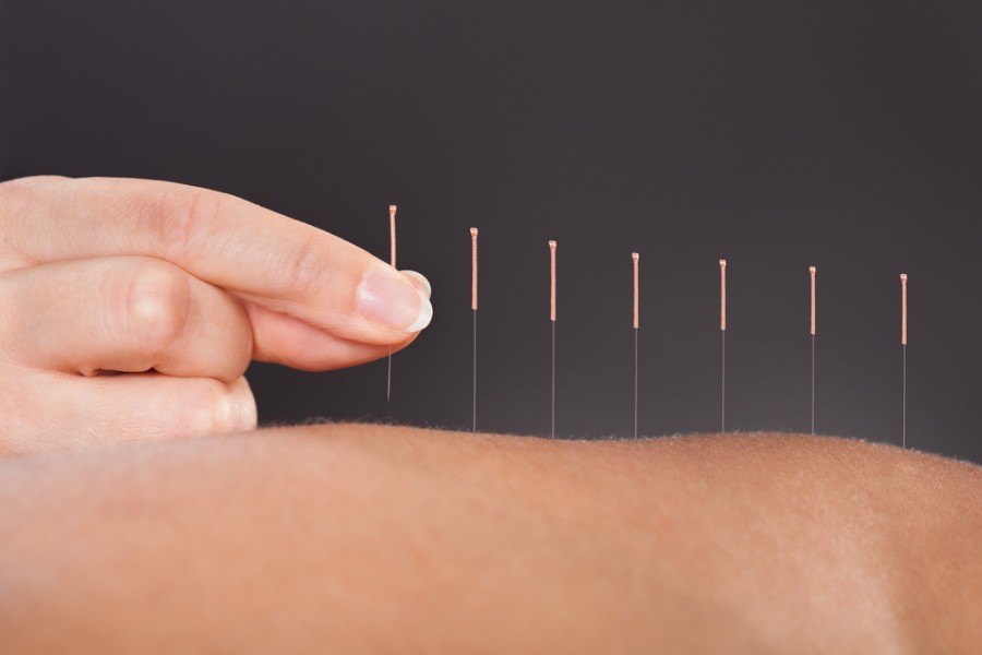 Quels sont les 12 points miraculeux d'acupuncture ?